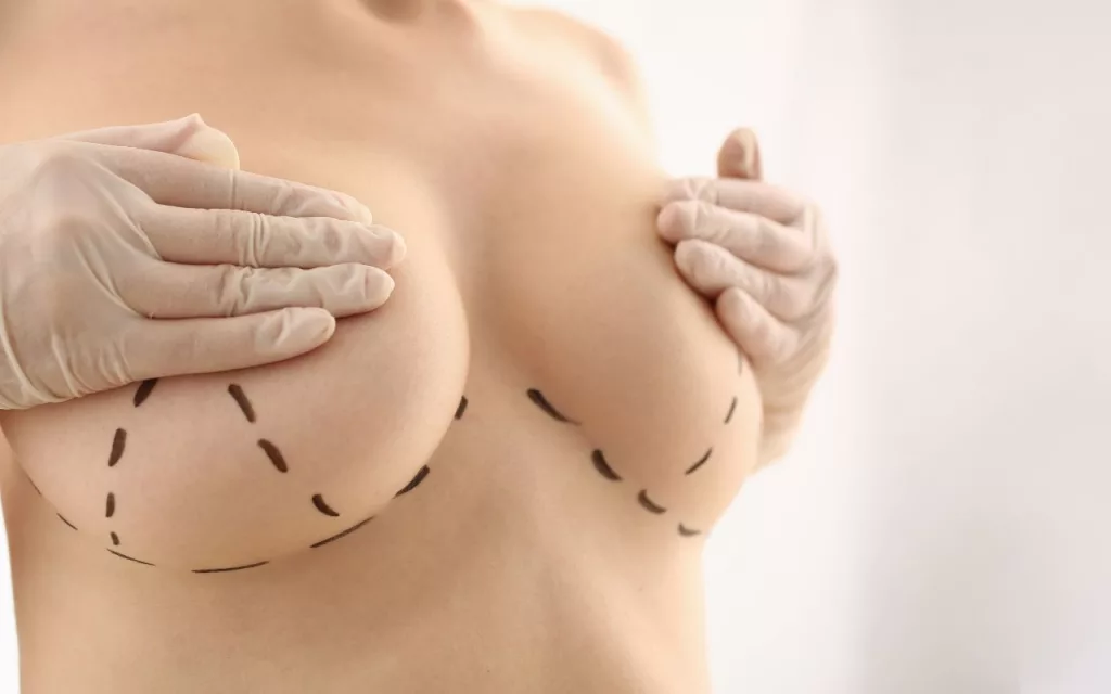 Breast Augmentation Surgery